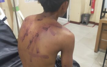 Warga Sukokerto Korban Dugaan Penganiayaan dan Penyekapan Melapor ke Polres Bondowoso, Orang Tua Korban Butuh Keadilan
